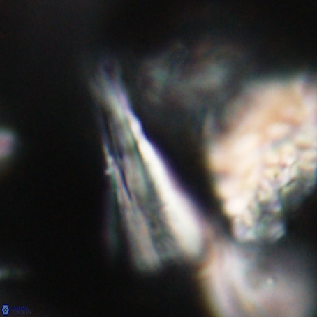 Pseudotriquetrorhabdulus stilus VR 31218