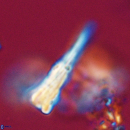 Pseudotriquetrorhabdulus stilus VR 31212