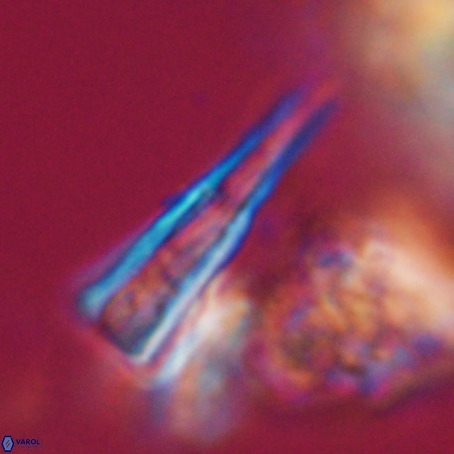 Pseudotriquetrorhabdulus stilus VR 31213