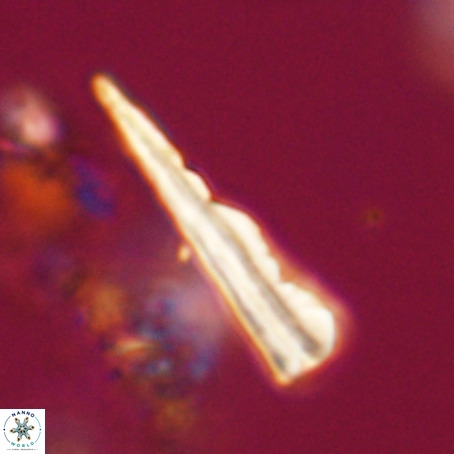 Pseudotriquetrorhabdulus stilus VR 31238