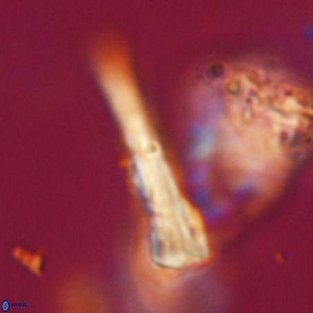 Pseudotriquetrorhabdulus stilus VR 31230