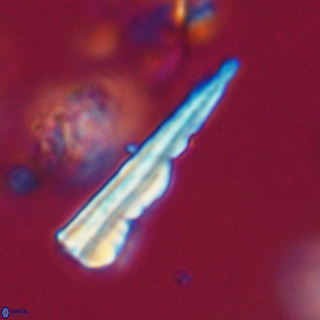 Pseudotriquetrorhabdulus stilus VR 31231