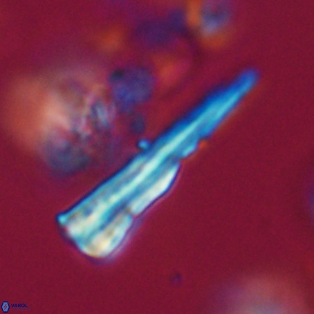 Pseudotriquetrorhabdulus stilus VR 31244