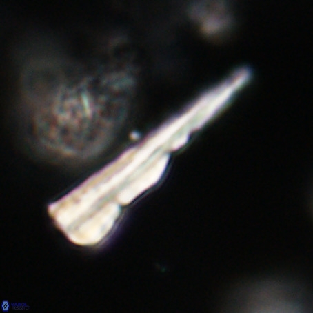 Pseudotriquetrorhabdulus stilus VR 31245