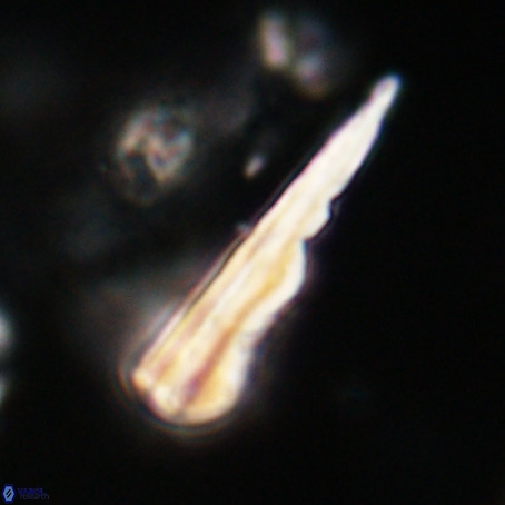 Pseudotriquetrorhabdulus stilus VR 31242