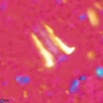 Pseudoblackites evrys VR 025252