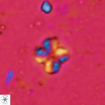 Pseudonannofossil sp 336