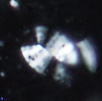 Prolatipatella multicarinata 1691