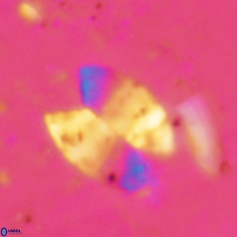 Prolatipatella multicarinata 1692