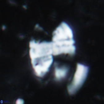 Prolatipatella multicarinata 1694