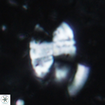 Prolatipatella multicarinata 1694
