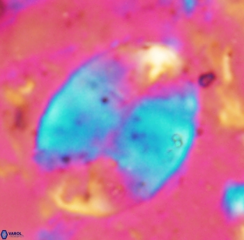 Prolatipatella multicarinata 1790