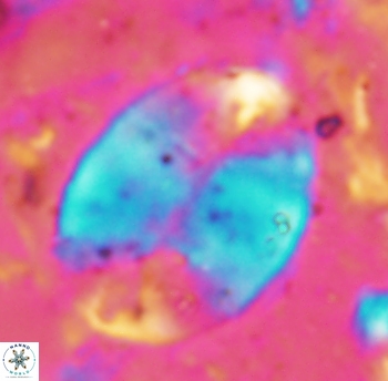 Prolatipatella multicarinata 1790