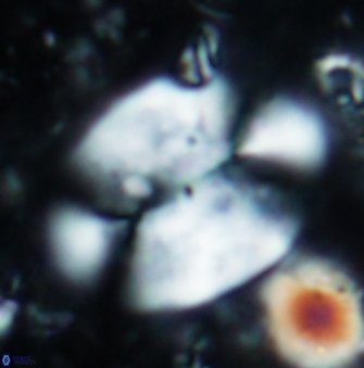 Prolatipatella multicarinata 1178