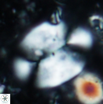 Prolatipatella multicarinata 1178