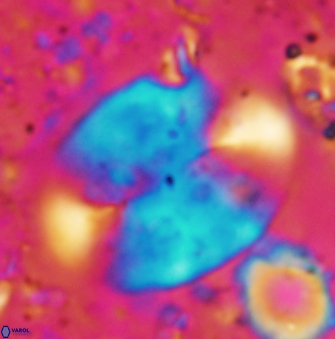 Prolatipatella multicarinata 1179