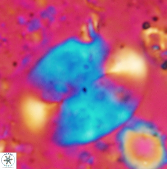 Prolatipatella multicarinata 1179