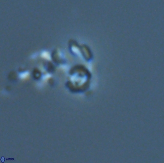 Praeprinsius tenuiculus 21996