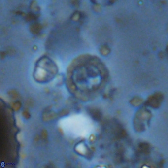Prediscosphaera columnata VR 14489