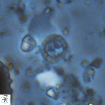 Prediscosphaera columnata VR 14489
