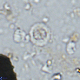 Prediscosphaera columnata VR 14495
