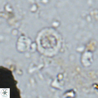 Prediscosphaera columnata VR 14495