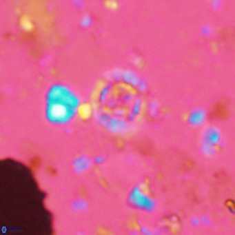 Prediscosphaera columnata VR 14498