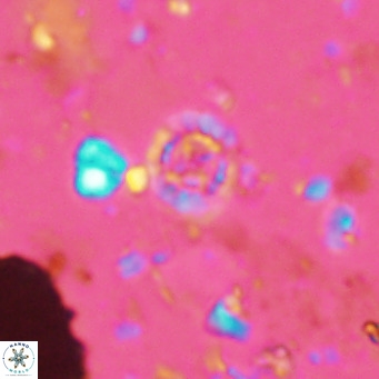 Prediscosphaera columnata VR 14498