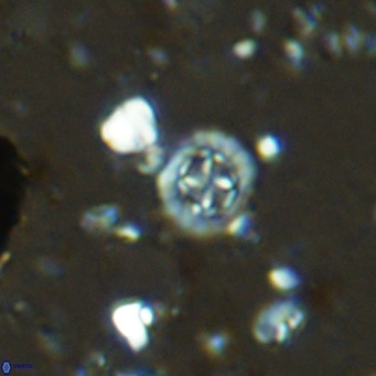 Prediscosphaera columnata VR 14499