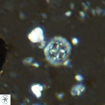 Prediscosphaera columnata VR 14499