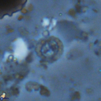 Prediscosphaera columnata VR 14491
