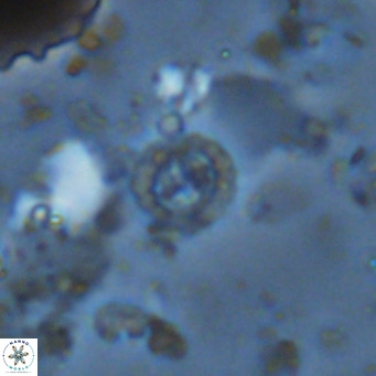 Prediscosphaera columnata VR 14491