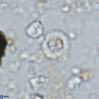 Prediscosphaera columnata VR 14493