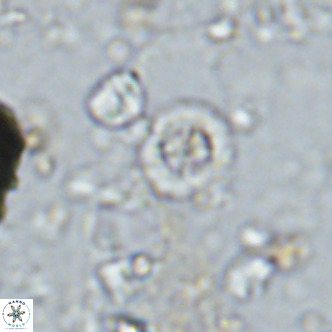 Prediscosphaera columnata VR 14493