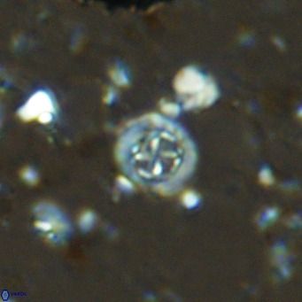 Prediscosphaera columnata VR 14505