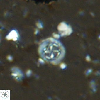 Prediscosphaera columnata VR 14505