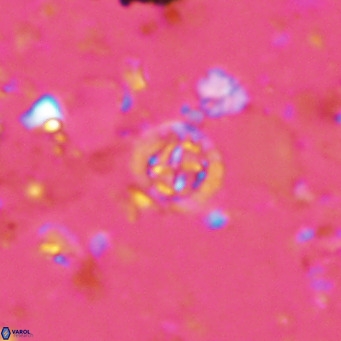 Prediscosphaera columnata VR 14506