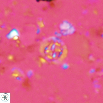 Prediscosphaera columnata VR 14506