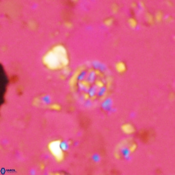 Prediscosphaera columnata VR 14500