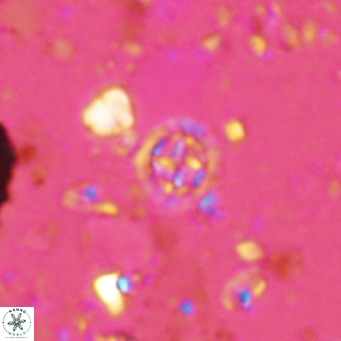 Prediscosphaera columnata VR 14500