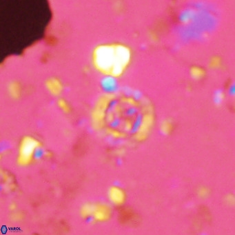 Prediscosphaera columnata VR 14502