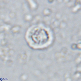 Prediscosphaera columnata VR 15134