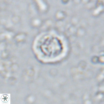 Prediscosphaera columnata VR 15134