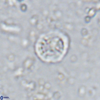Prediscosphaera columnata VR 15136