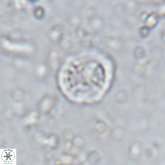Prediscosphaera columnata VR 15136