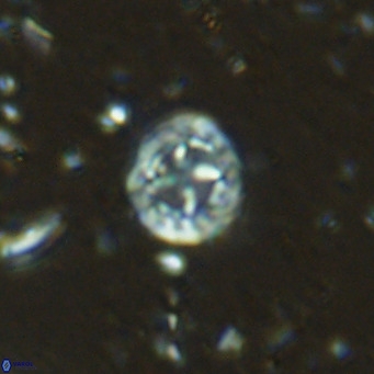 Prediscosphaera columnata VR 15139
