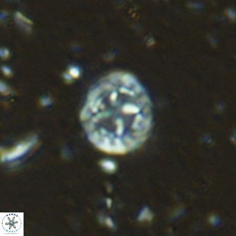 Prediscosphaera columnata VR 15139