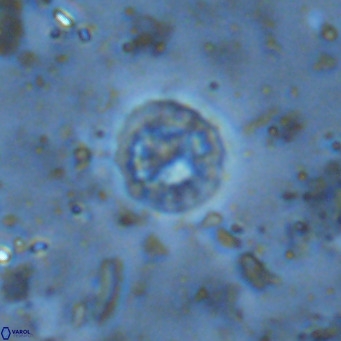 Prediscosphaera columnata VR 15130