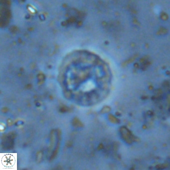 Prediscosphaera columnata VR 15130
