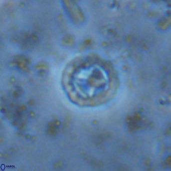Prediscosphaera columnata VR 15133